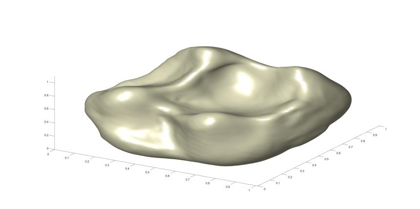 reconstructed tooth surface
